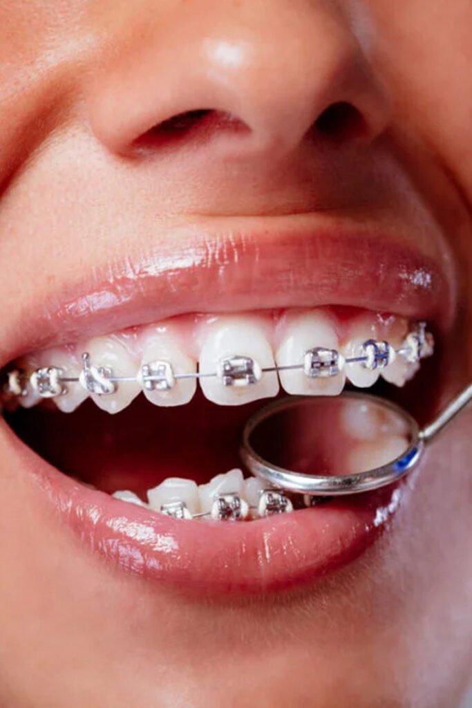 Orthodontics