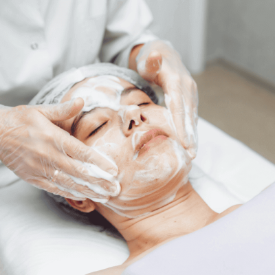 Chemical Peel4