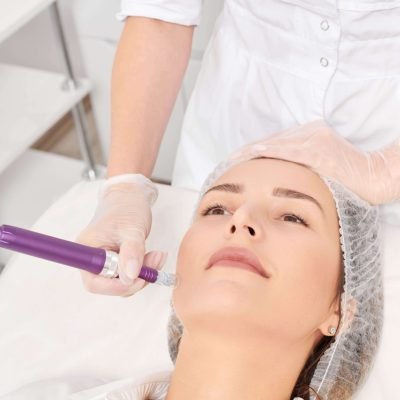 Dermapen 2