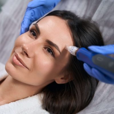Dermapen 3