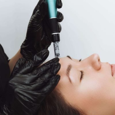Dermapen 4