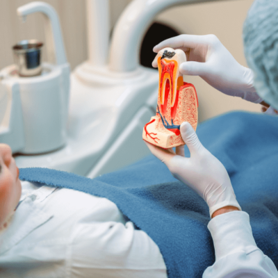Root Canal2