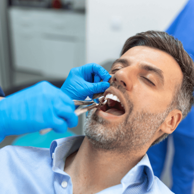 Teeth Extraction1