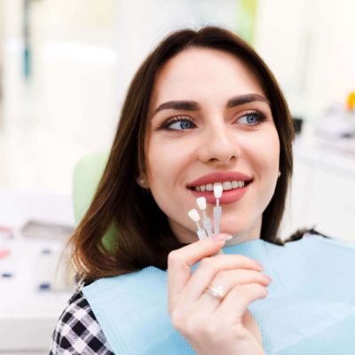 Veneers5