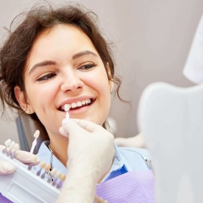 Veneers8