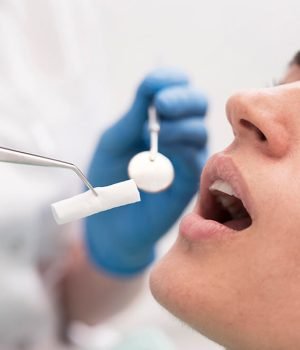 female-patient-having-procedure-done-dentist
